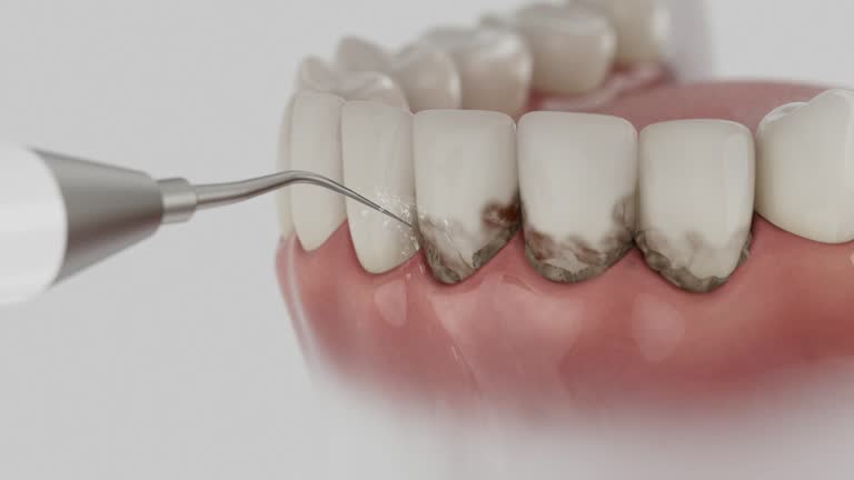 Trusted Wisdom Tooth Removal service in Elgin, TX - Dentist Open Now